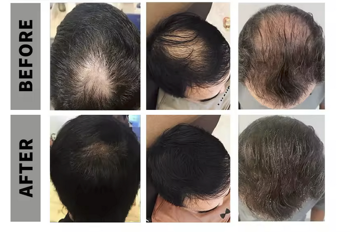 Spray cu Microfibre de Keratină pentru Păr Mai Des